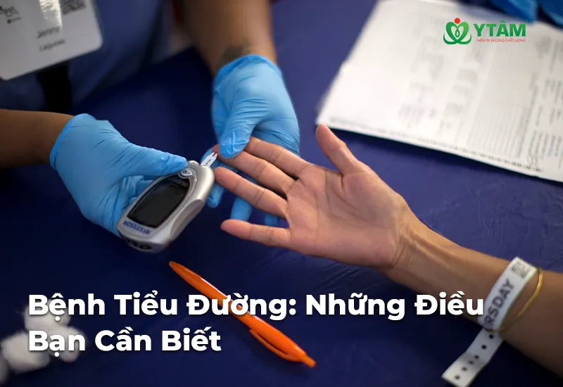 Bệnh Tiểu Đường: Những Điều Bạn Cần Biết