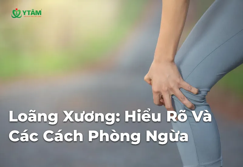 Loãng Xương: Hiểu Rõ Và Các Cách Phòng Ngừa