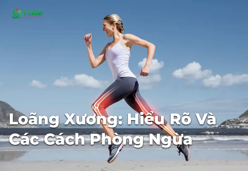 Loãng Xương: Hiểu Rõ Và Các Cách Phòng Ngừa