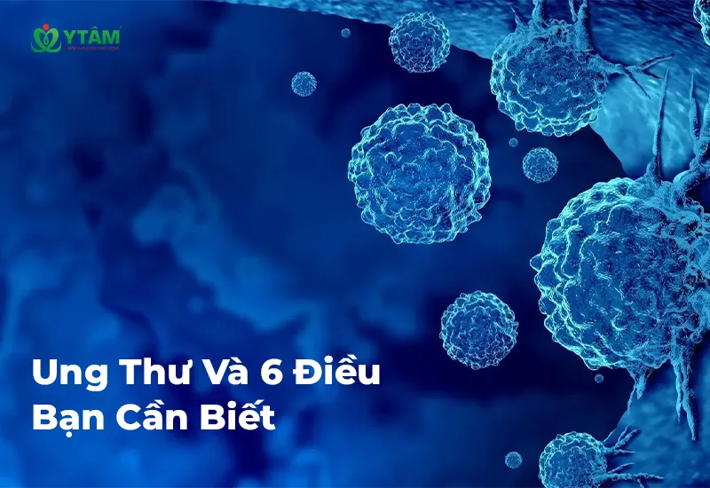 Ung Thư Và 6 Điều Bạn Cần Biết