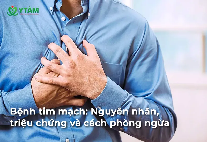 Bệnh tim mạch: Nguyên nhân, triệu chứng và cách phòng ngừa