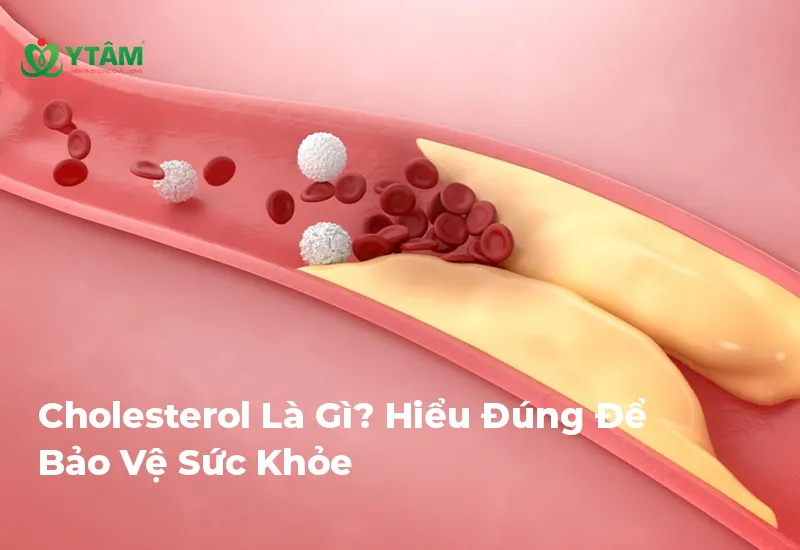 Cholesterol Là Gì? Hiểu Đúng Để Bảo Vệ Sức Khỏe