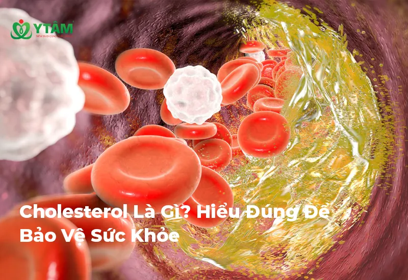 Cholesterol Là Gì? Hiểu Đúng Để Bảo Vệ Sức Khỏe