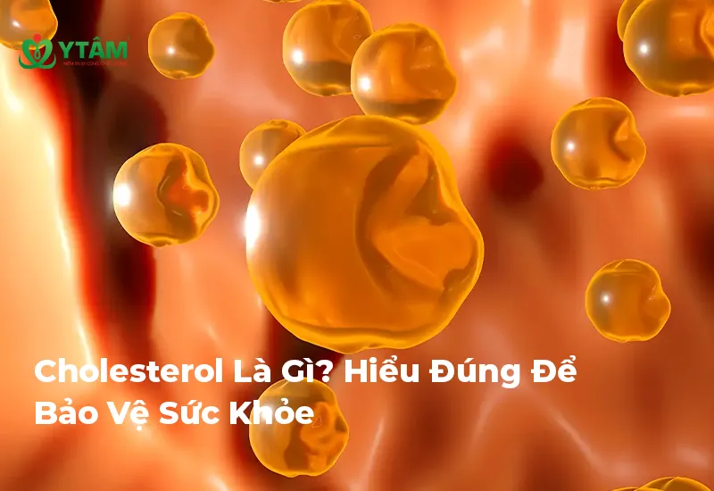 Cholesterol Là Gì? Hiểu Đúng Để Bảo Vệ Sức Khỏe