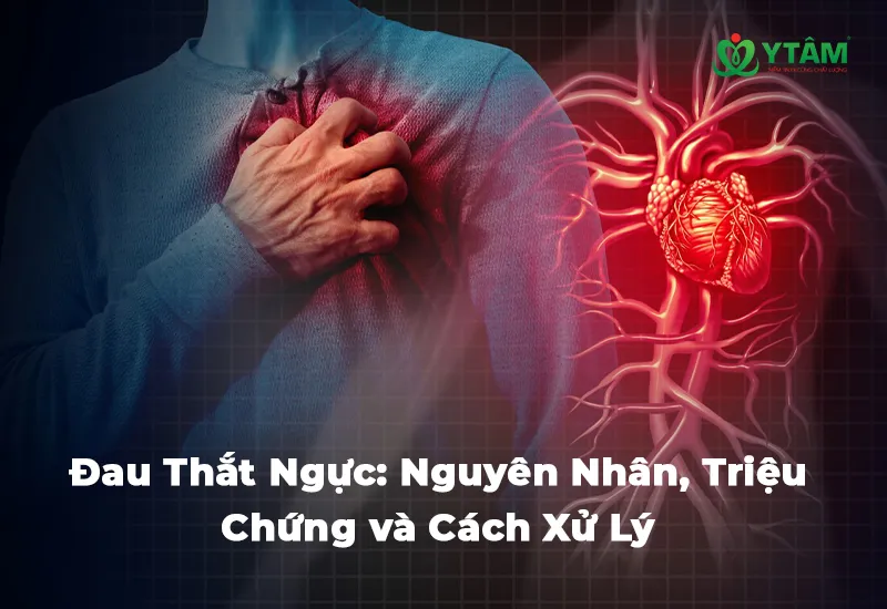 Đau Thắt Ngực: Nguyên Nhân, Triệu Chứng và Cách Xử Lý