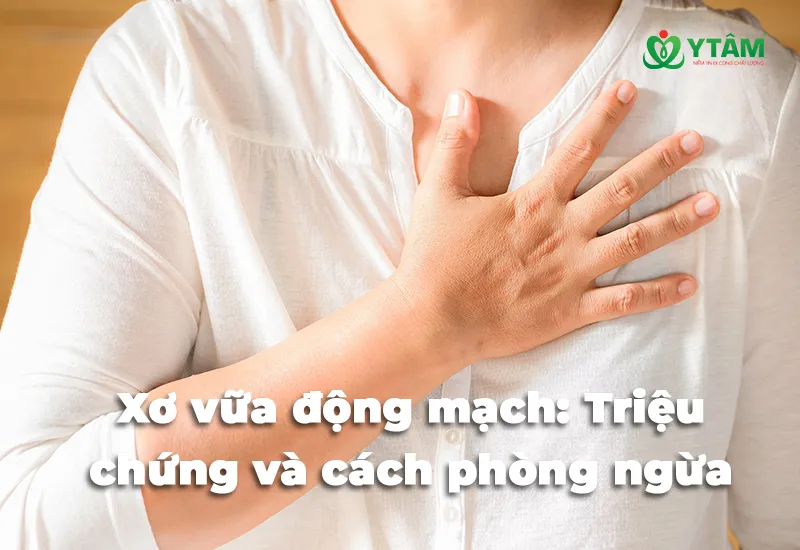 Xơ vữa động mạch: Triệu chứng và cách phòng ngừa