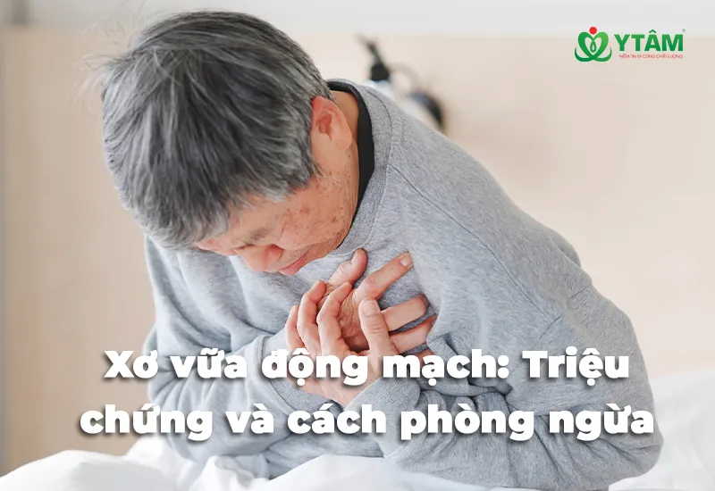 Xơ vữa động mạch: Triệu chứng và cách phòng ngừa