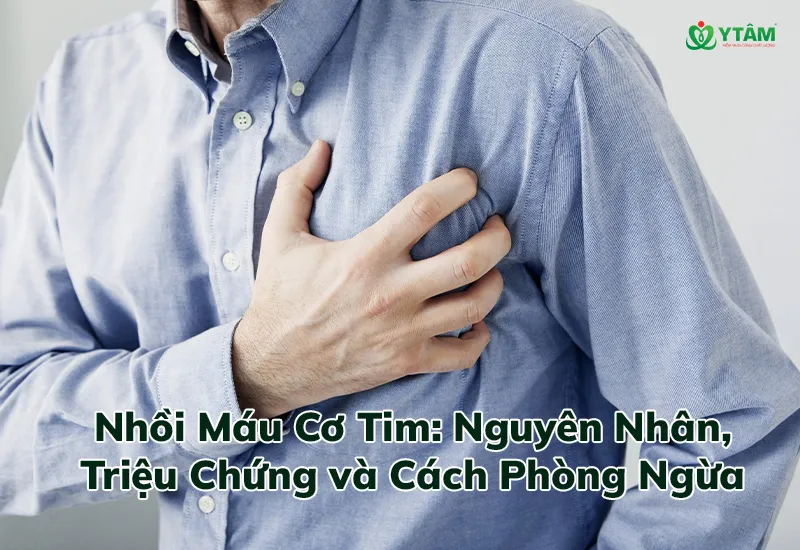 Nhồi Máu Cơ Tim: Nguyên Nhân, Triệu Chứng và Cách Phòng Ngừa