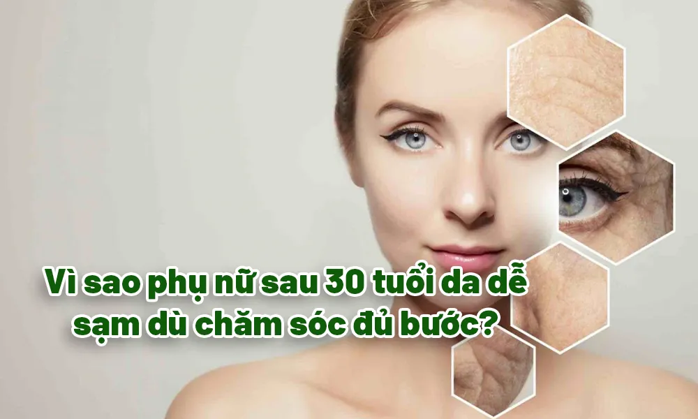 Hỗ Trợ Sức Khỏe Vì sao phụ nữ sau 30 tuổi da dễ sạm dù chăm sóc đủ bước?